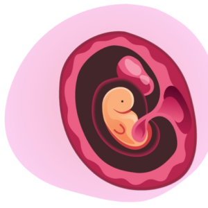 Zedu Early Pregnancy Assessment for Sonographers course - join us for an immersive and practical experience to fast-track your skills development and get you work-ready