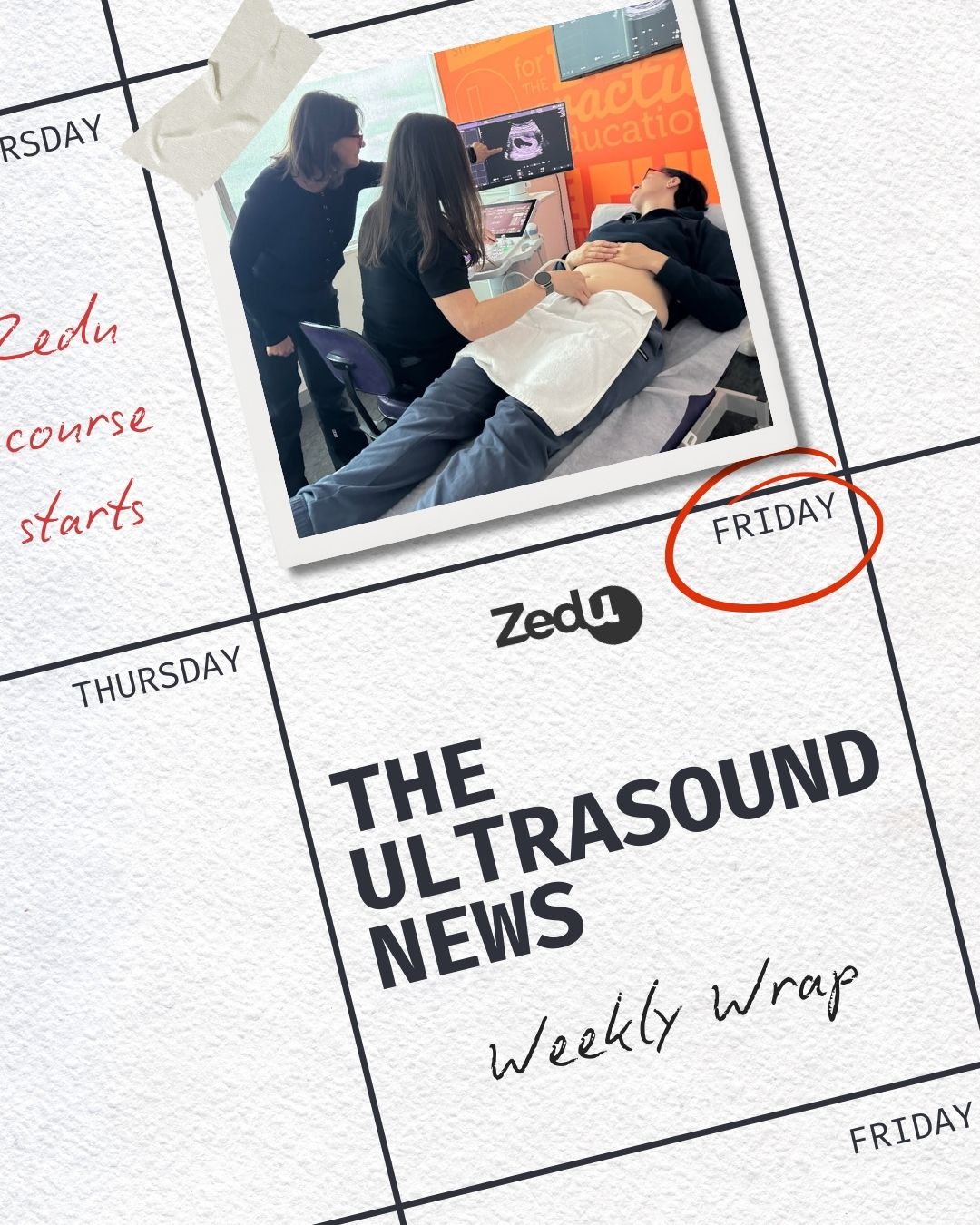 The Zedu weekly wrap - bringing together the best in free ultrasound news, views and opinions from across the internet.