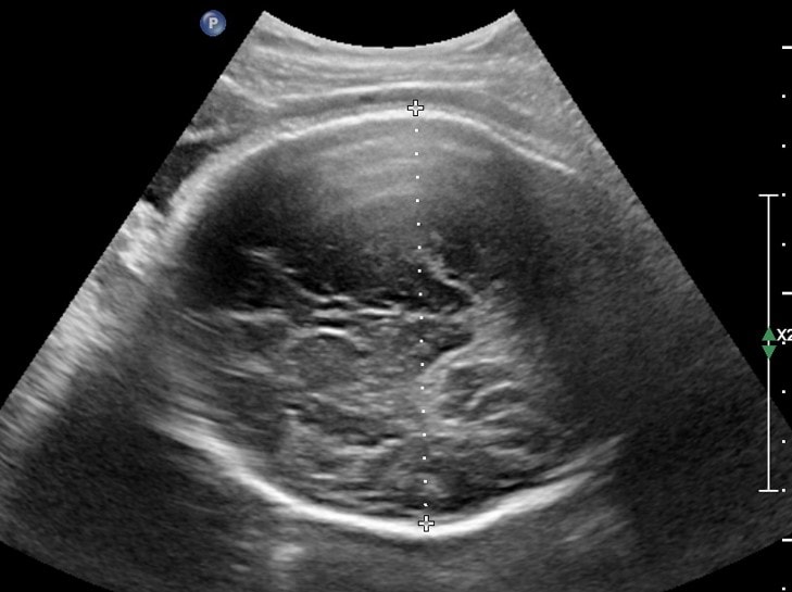 Why Choose Zedu Ultrasound Training Solutions