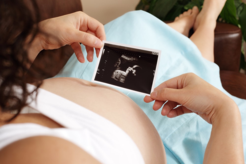 Zedu 2nd trimester ultrasound fast-track for sonographers middle cerebral artery