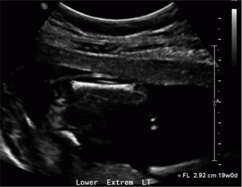 Zedu 2nd trimester ultrasound fast-track for sonographers middle cerebral artery assess fetal wellbeing transvaginal scanning techniques