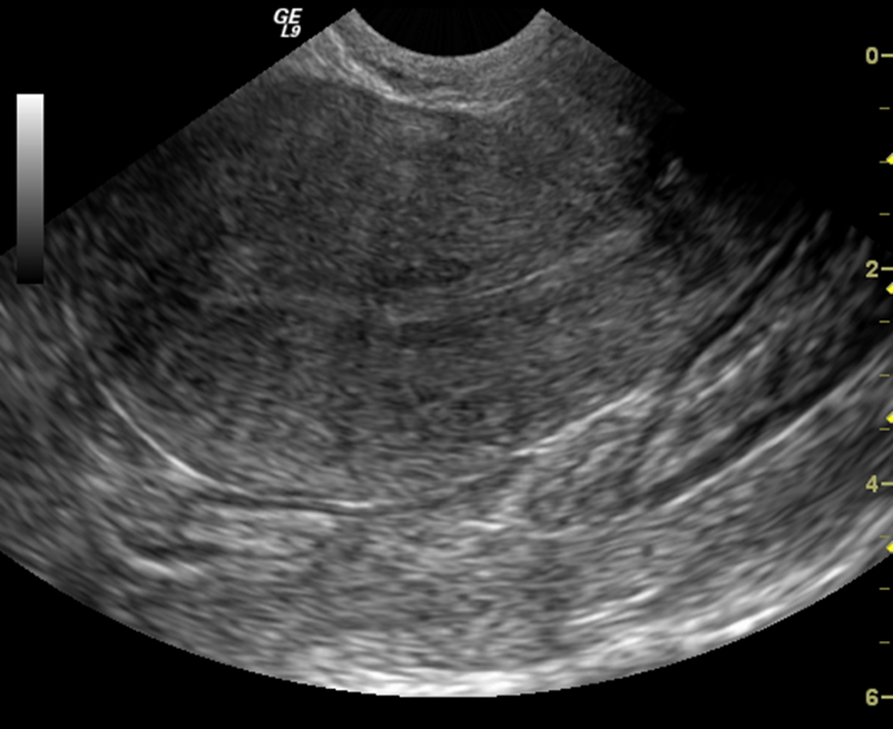 Zedu early pregnancy and gynaecology womens health obstetric ultrasound training fast track course for sonographers