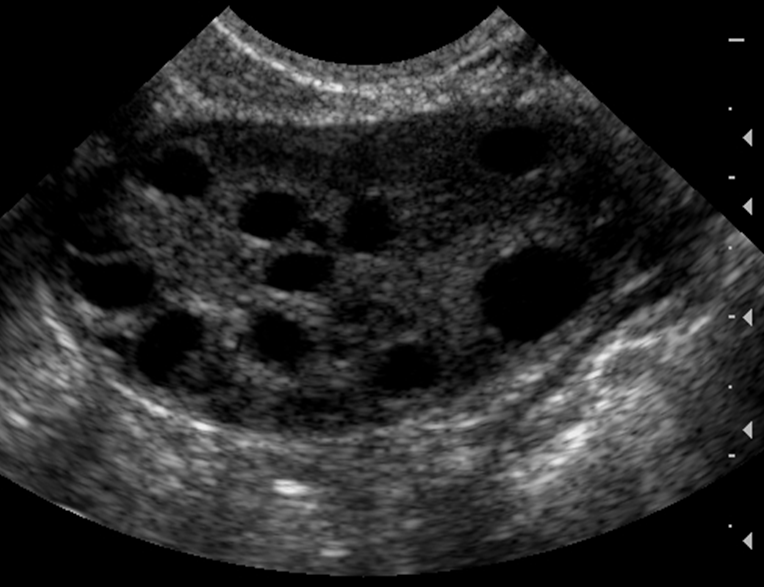 Zedu early pregnancy and gynaecology womens health ovary ultrasound training fast track course for sonographers