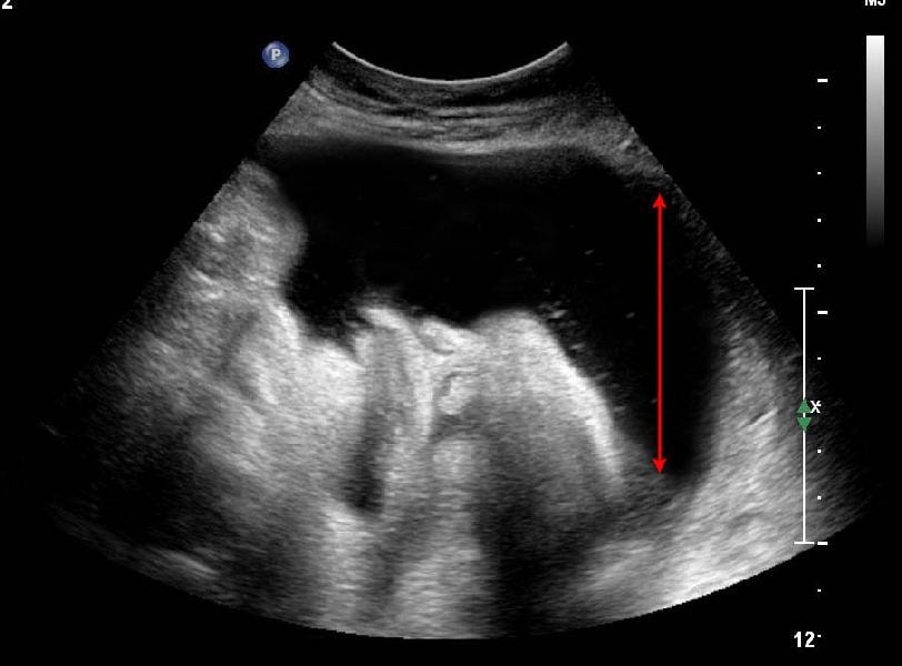 Zedu 3rd trimester fetal presentation obstetric ultrasound training fast track course for sonographers