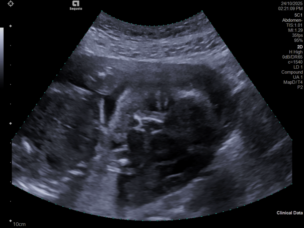 Zedu 3rd trimester obstetric ultrasound training fast track for sonographers