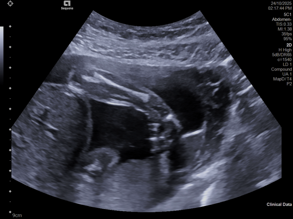 Zedu 3rd trimester obstetric ultrasound training fast track course for sonographers