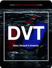 DVT