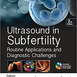 ultrasound-subfertility