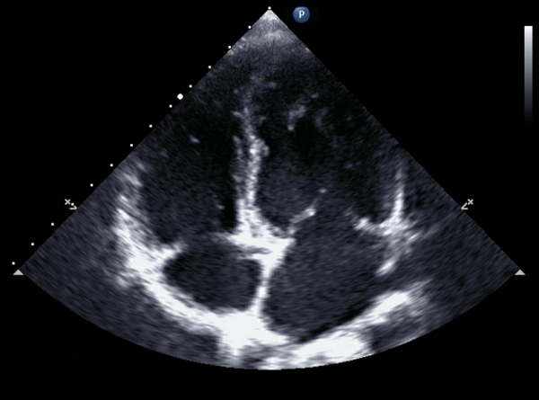 Why-is-learning-ultrasound-so-important-600x445